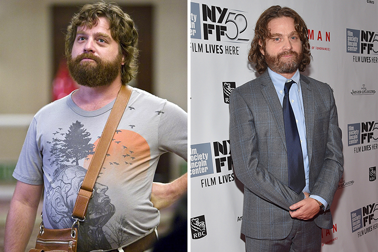 Photo of Zach Galifianakis who lost 60 lbs