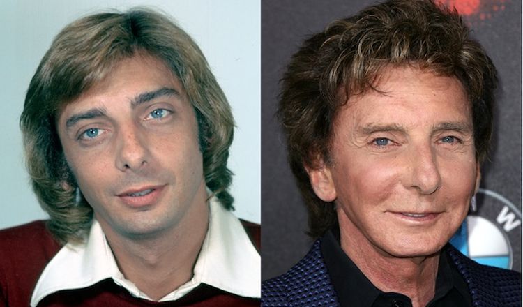 Photo of Barry Manilow Before And After Rhinoplasty 