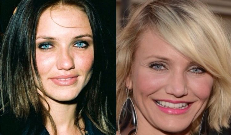 Photo of Cameron Diaz Before And After Rhinoplasty 