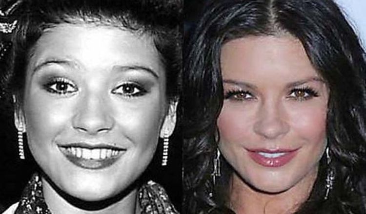 Photo of Catherine Zeta-Jones Before And After Rhinoplasty 