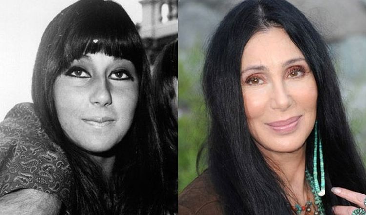 Photo of Cher Before And After Rhinoplasty 