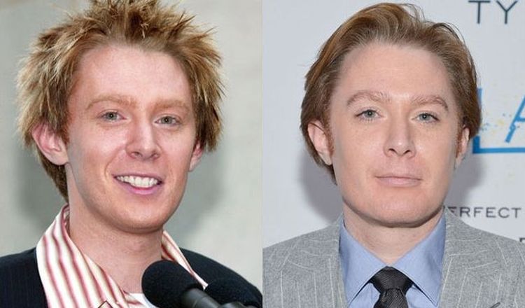 Photo of Clay Aiken Before And After Rhinoplasty 