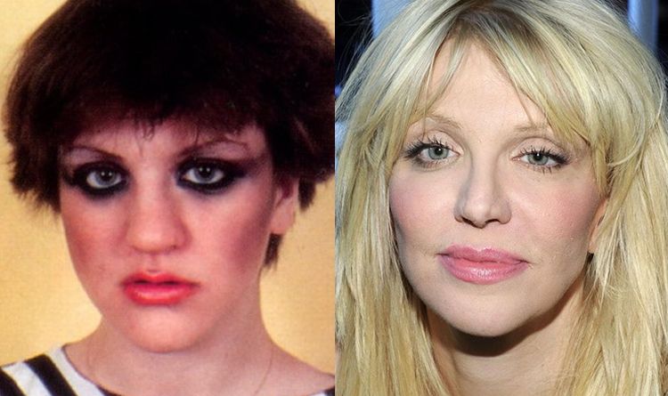 Photo of Courtney Love Before And After Rhinoplasty 