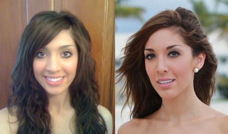 Photo of Farrah Abraham Before And After Rhinoplasty 