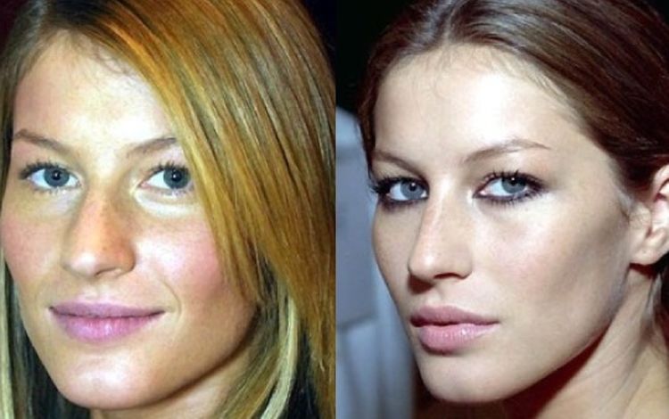 Photo of Gisele Bundchen Before And After Rhinoplasty 