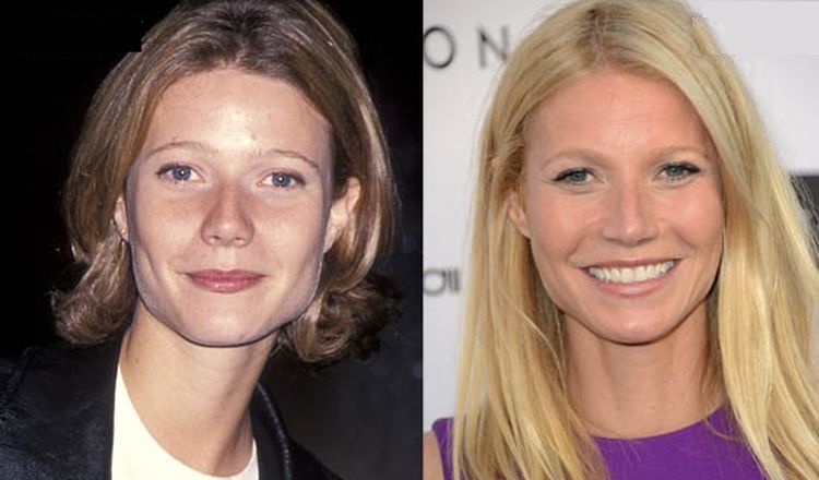 Photo of Gwyneth Paltrow Before And After Rhinoplasty 