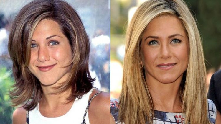 Photo of Jennifer Aniston Before And After Rhinoplasty 