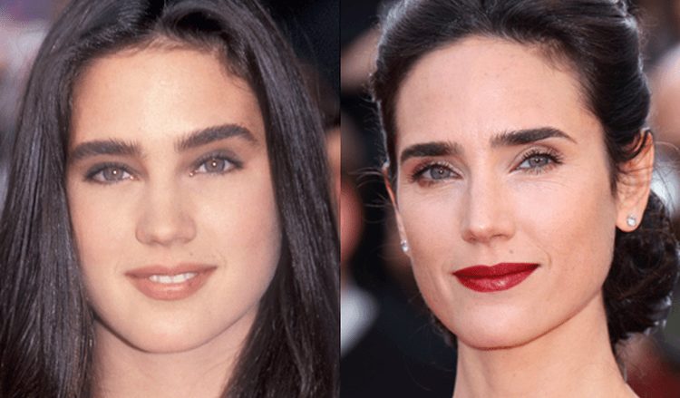 Photo of Jennifer Connelly Before And After Rhinoplasty 