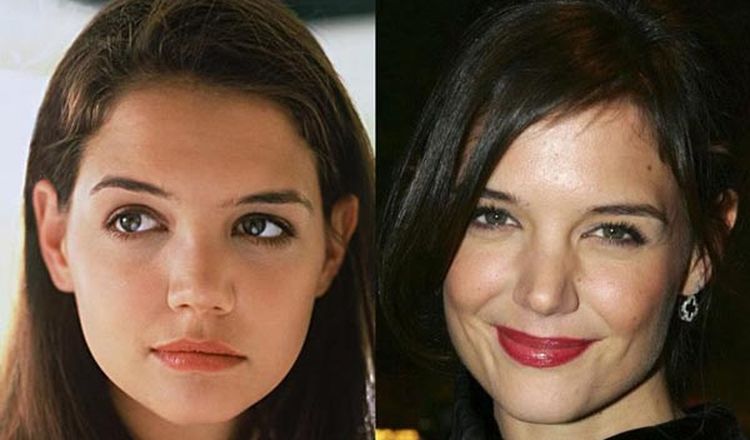 Photo of Katie Holmes Before And After Rhinoplasty 