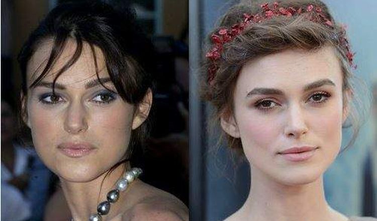 Photo of Keira Knightley Before And After Rhinoplasty 