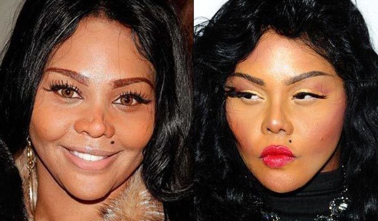 Photo of Lil Kim Before And After Rhinoplasty 