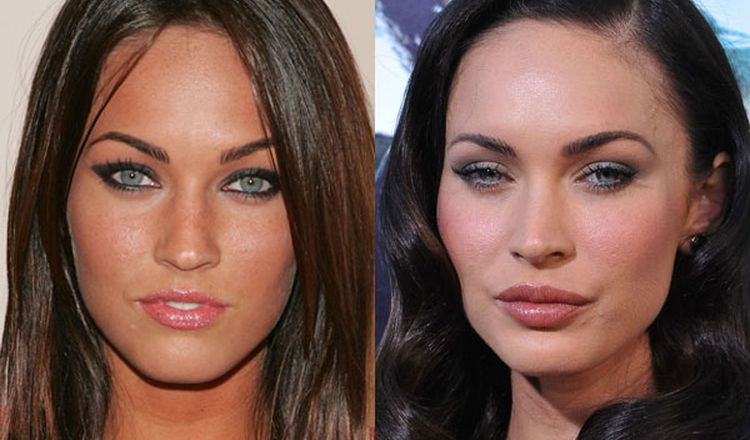 Photo of Megan Fox Before And After Rhinoplasty 