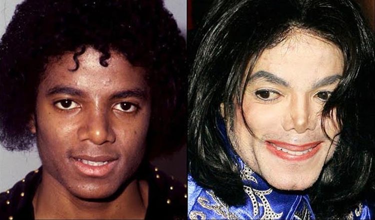 Photo of Michael Jackson Before And After Rhinoplasty 