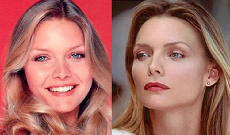 Photo of Michelle Pfeiffer Before And After Rhinoplasty 