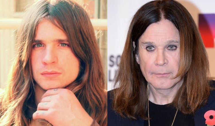 Photo of Ozzy Osbourne Before And After Rhinoplasty 