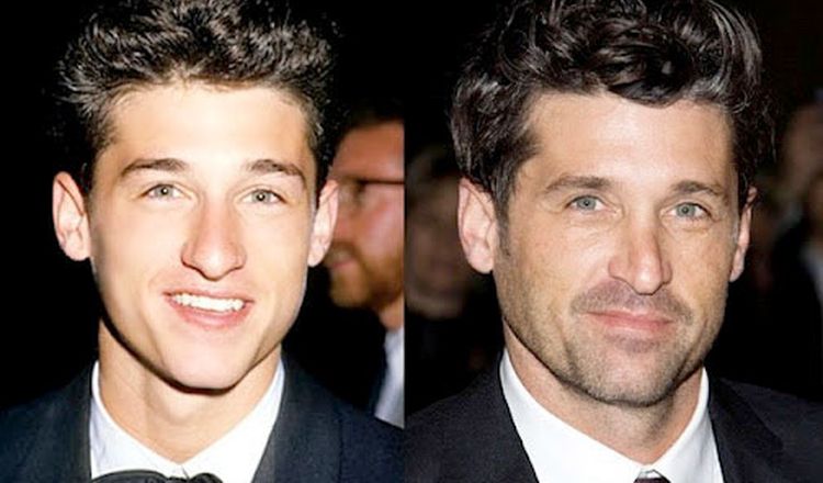 Photo of Patrick Dempsey Before And After Rhinoplasty 