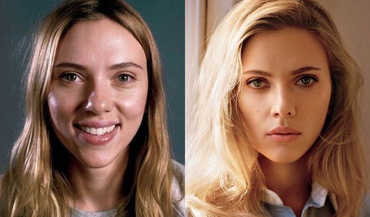 Photo of Scarlett Johansson Before And After Rhinoplasty 