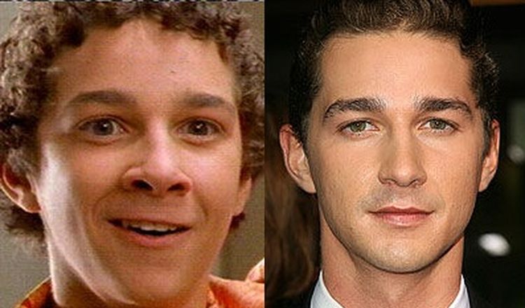 Photo of Shia Lebeouf Before And After Rhinoplasty 