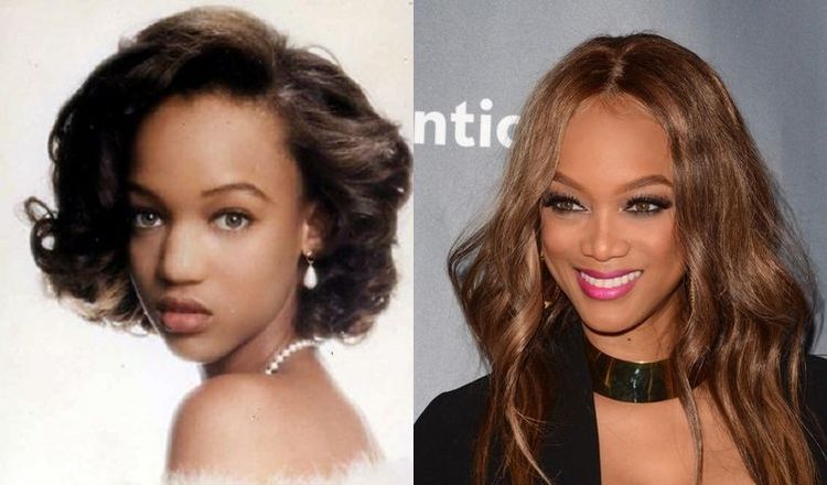 Photo of Tyra Banks Before And After Rhinoplasty 