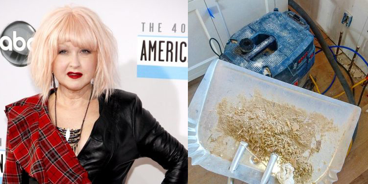 Image of Cyndi Lauper who suffers from allergy