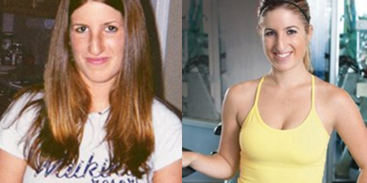 Image of Missy Engel before and after amazing weight loss transformation