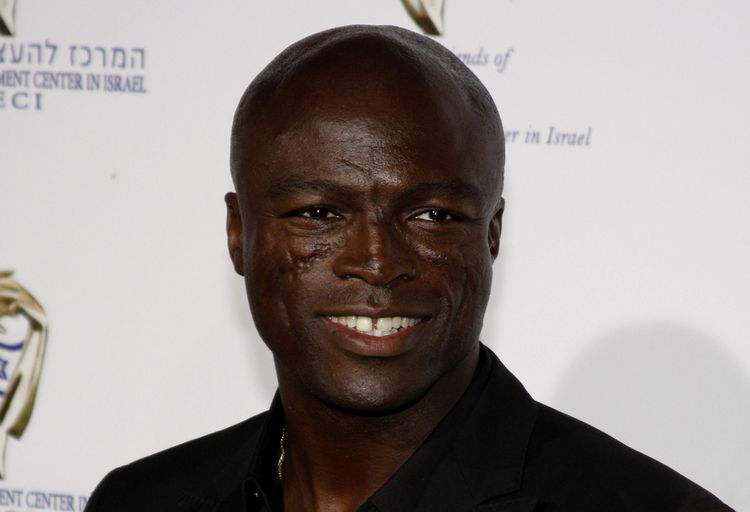 Photo of British singer Seal who suffered from discoid lupus erythematosus