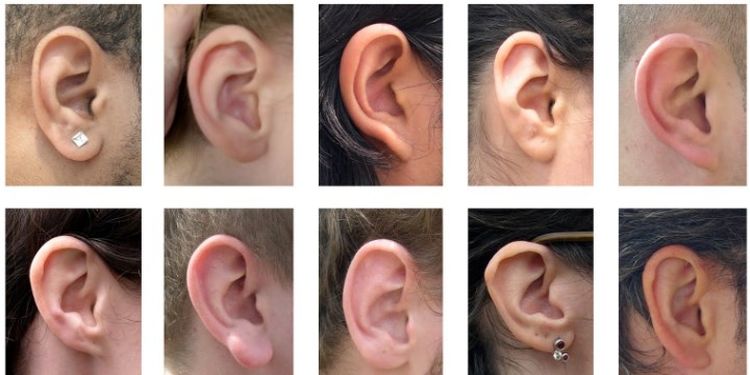 image of ear shapes