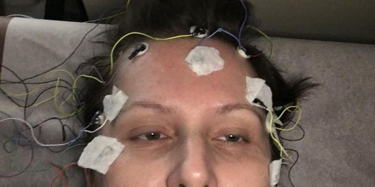 Image of a woman suffering from Migraine Headaches 