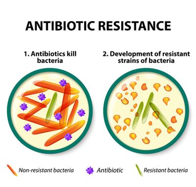 Illustration of how Antibiotic Resistance works