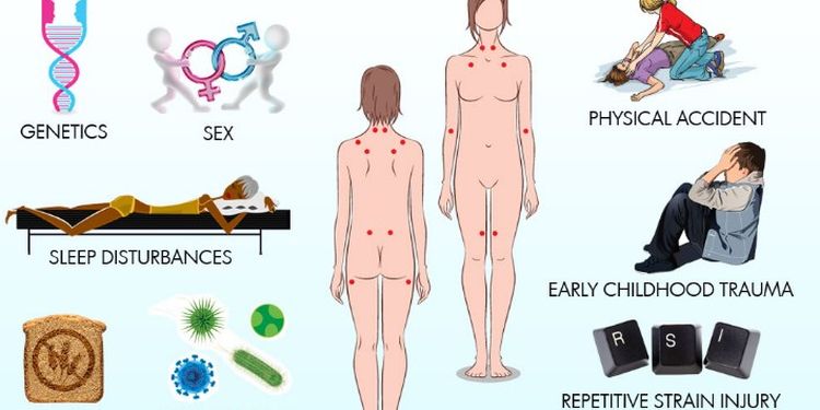 Image of fibro risk factors scheme