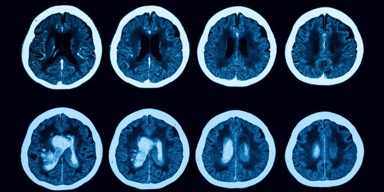 Image of a human brain cross section