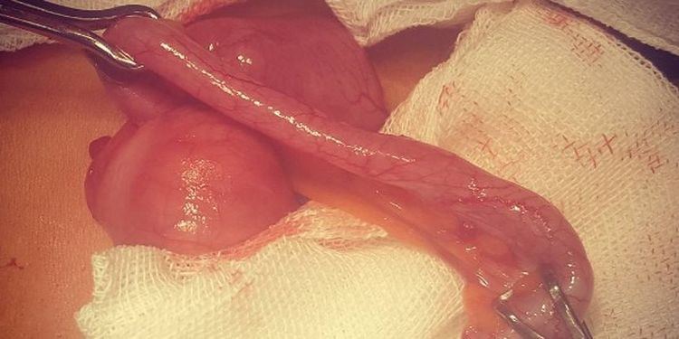 Image of appendix