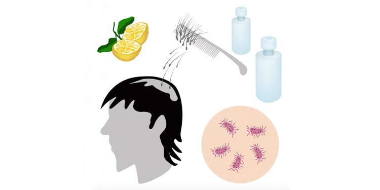 Illustration of hair loss