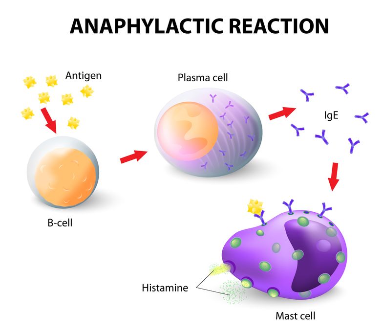 illustration of an Anaphylactic Reaction