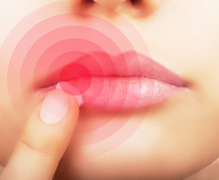 Photo of Applying Cream On Lips Affected By Hepres