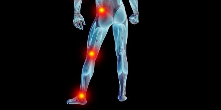 Illustration of joint pain in body