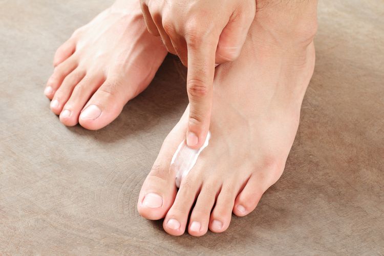 Photo of an Athlete's Foot Treatment