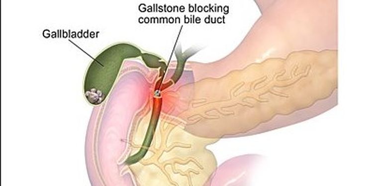 Image of biliary dyskinesia