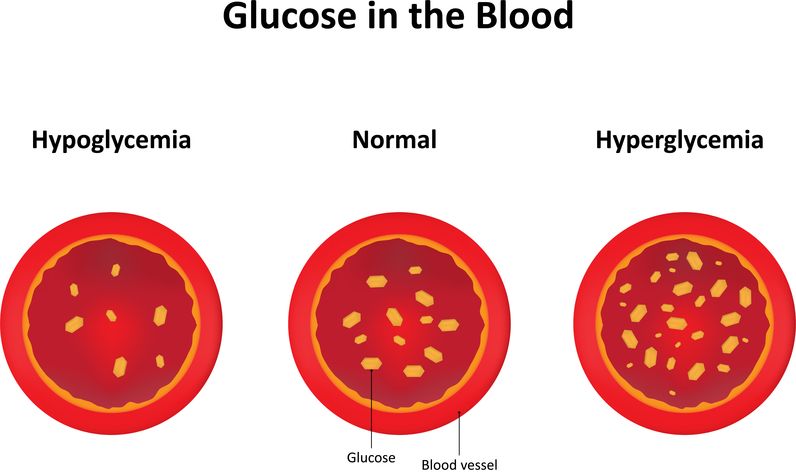 Illustration of Blood Glucose state