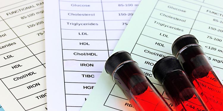 Photo of blood tubes for testing