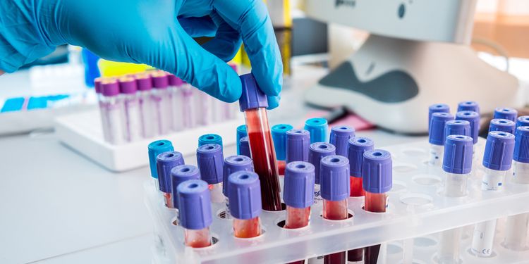 Photo of blood testing tubes in lab