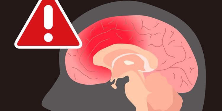 Illustration of inflammation in brain