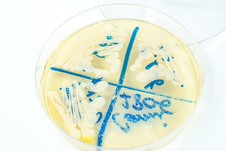 Photo of a candida colony in a Petri Dish - Chronic Candida Infection