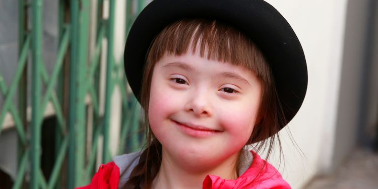 Photo of cute girl with Down Syndrome smiling