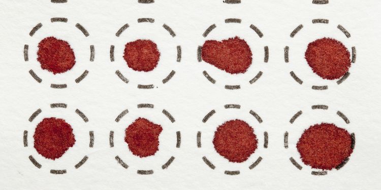 Photo of a sheet with dried blood spot tests