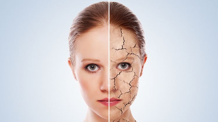 Photo of a woman with cracks in her dry face skin