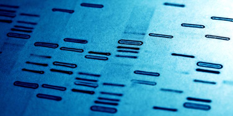 Photo of PCR results 