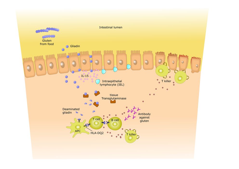 Gluten Reaction