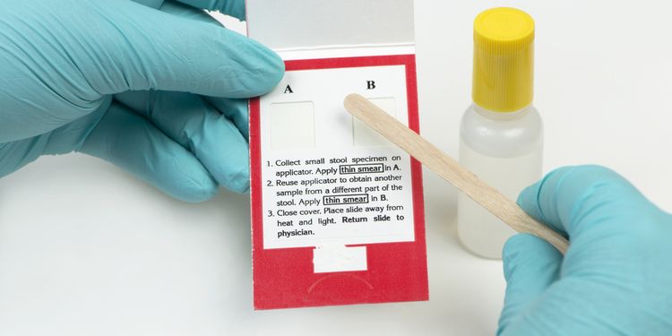 Photo of lab testing kit