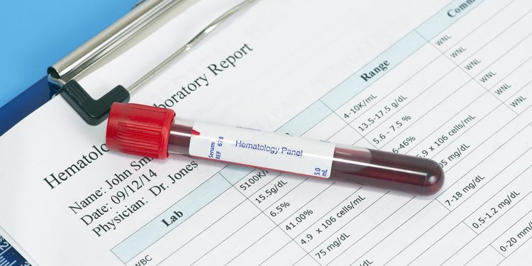 Photo of a blood tube in lab with results on desk